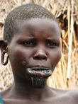 Jihozápadní Etiopie, údolí Omo, Kibish, kmen Surma (Sari): tato dívka má čerstvě proražený ret, do kterého má vsazenou zatím malou destičku (spiše kalíšek)